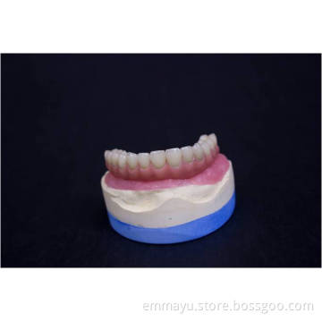 Implant Porcelain Teeth